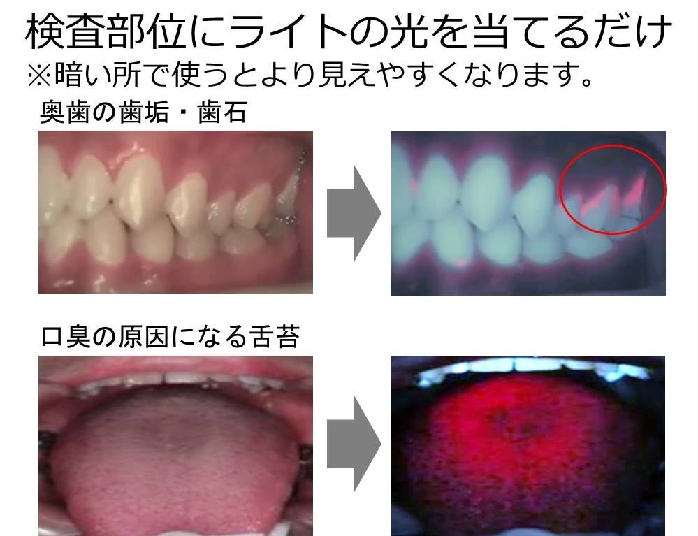 hapic(歯の歯石、歯垢を照らします) Amazon.co.jp: 【ヒロコーポレーション】デンタルチェックライト
