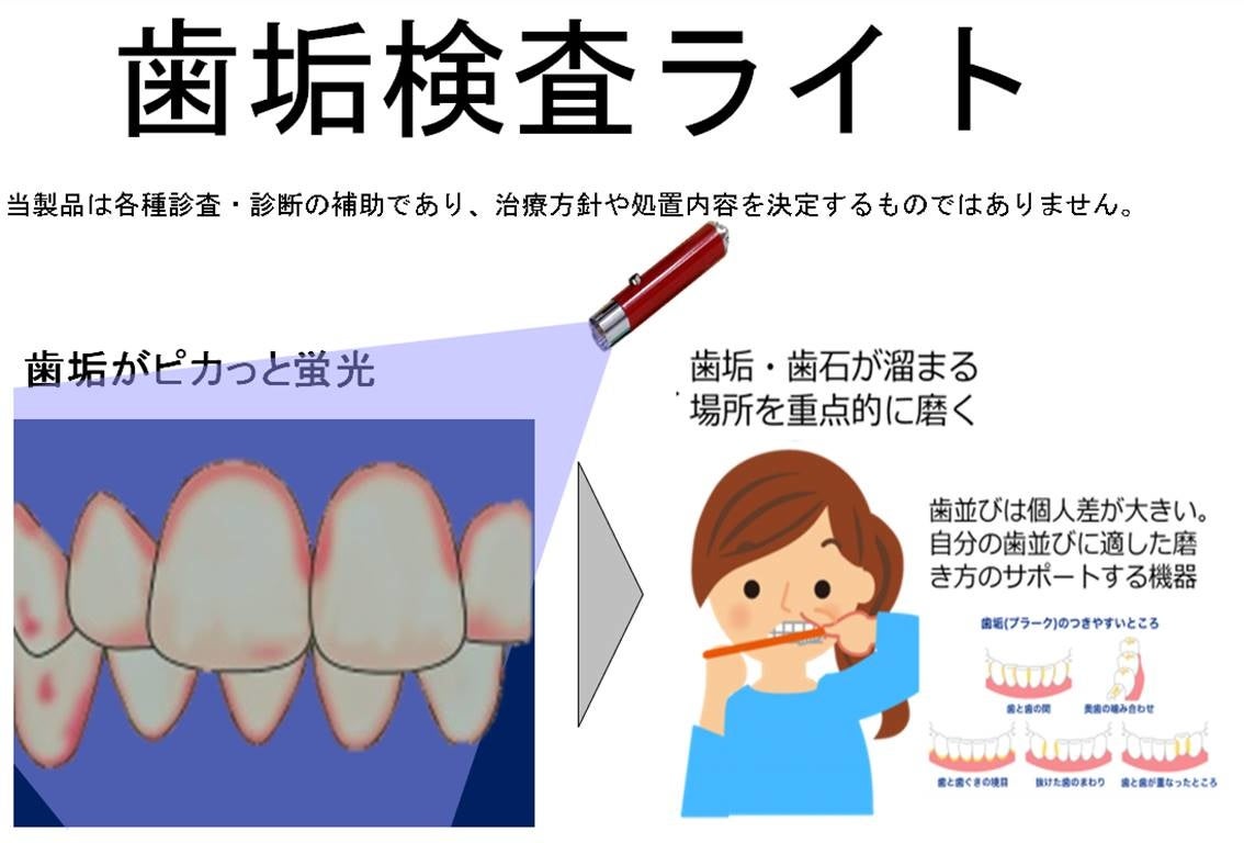 光を当てるだけの新しい歯垢の可視化方法 QLFライト | 歯っぴー