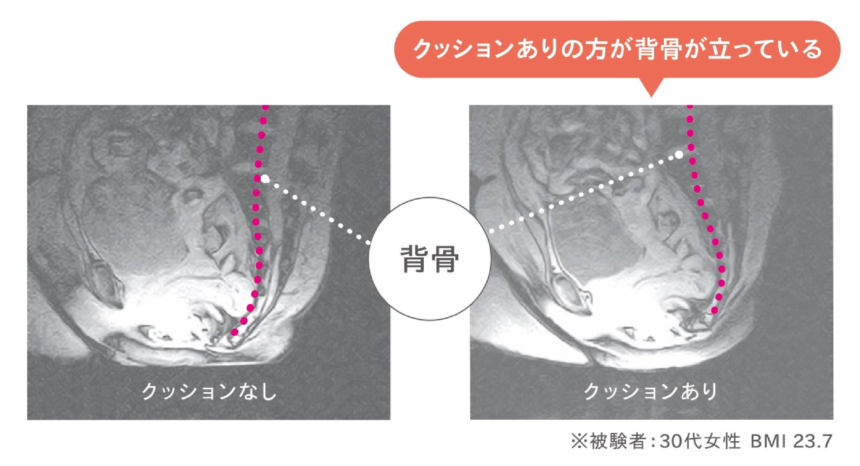 骨盤ホールド 検証結果