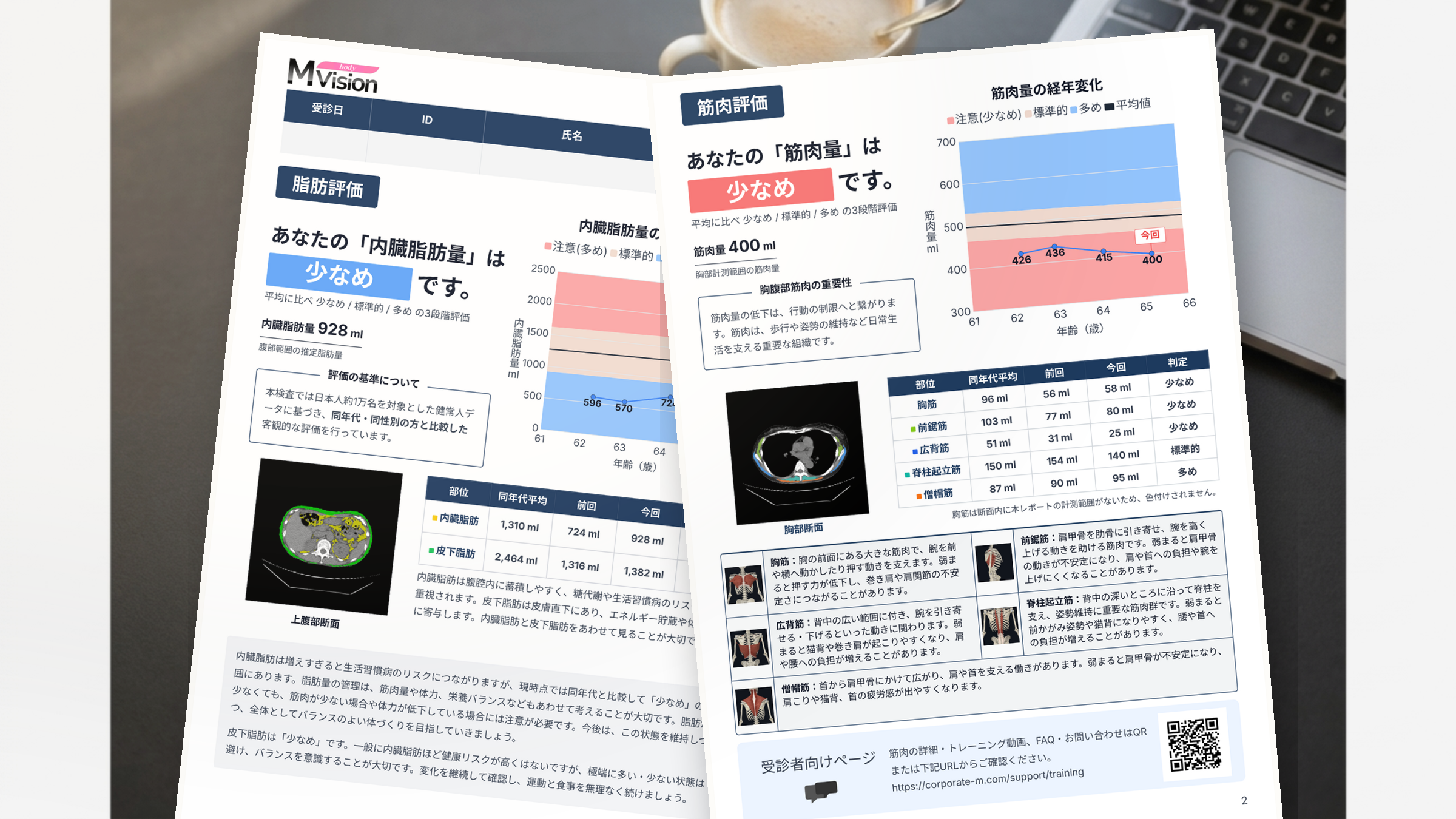 株式会社エム、既存のCT画像をAIで解析し、脂肪量・筋肉量・筋肉の質を可視化する 「MVision body」 のサービス提供を本格開始