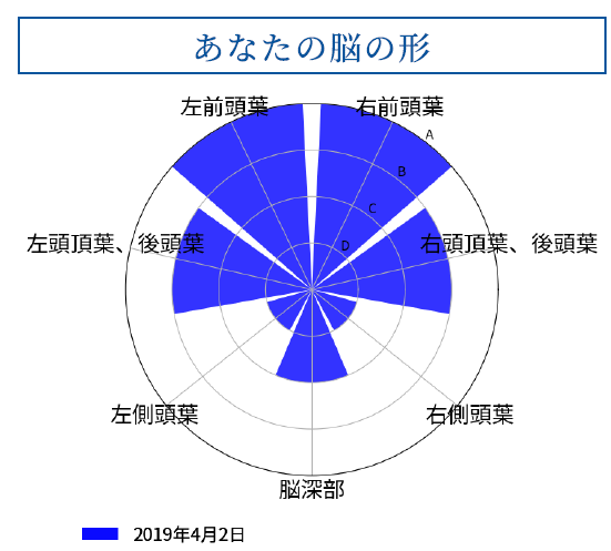脳の構造別の萎縮度合いも評価する