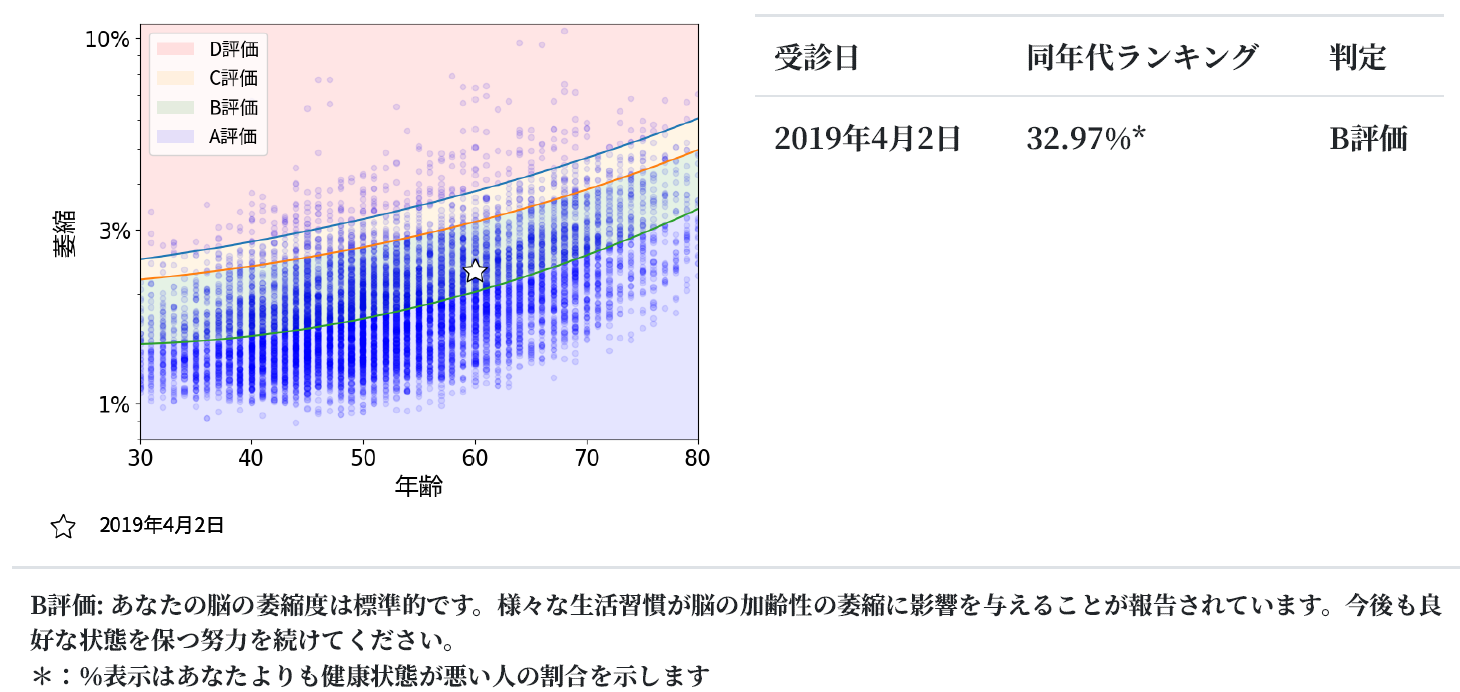 脳の萎縮度合いを同年代比較する