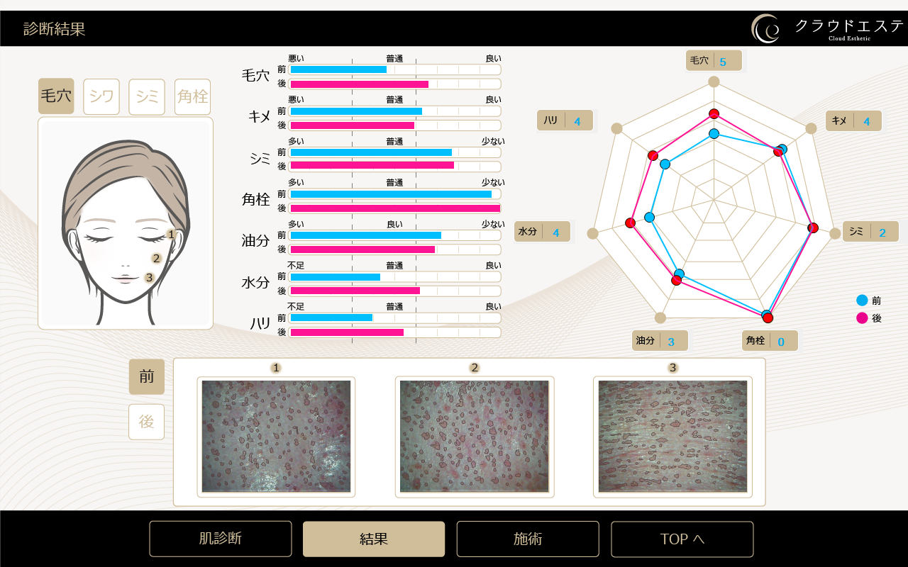 ▲診断・測定結果イメージ（施術後）