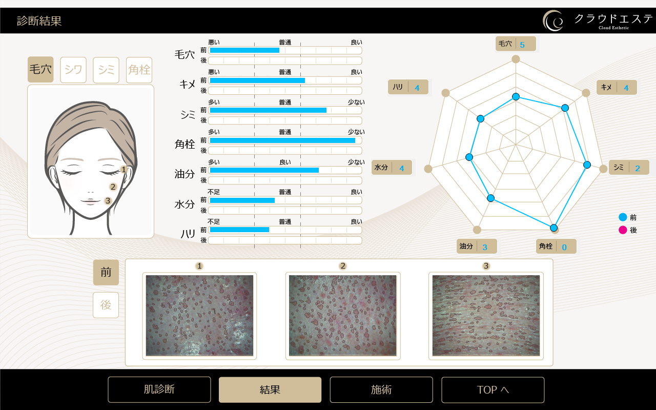 ▲診断・測定結果イメージ（施術前）