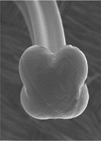 （クシ歯拡大イメージ）