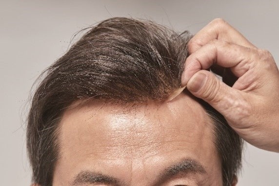 「ヘアシステム」取り付けイメージ