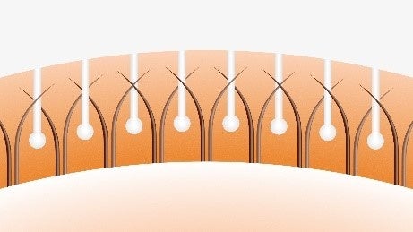 自髪をキャッチする簡単ストッパー「スマートタッチ」（イメージ）