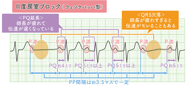 実際の波形に直接解説を記載してわかりやすく解説