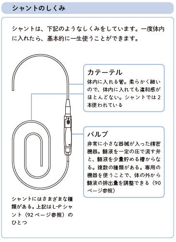 図解でよくわかる