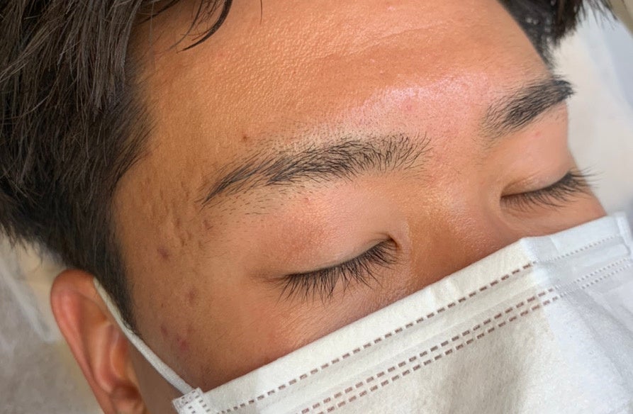 メンズの施術も承っております。