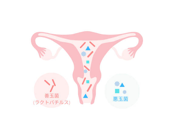 子宮内・膣内フローラ