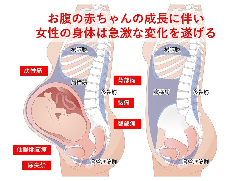 図２．妊娠に伴う身体変化