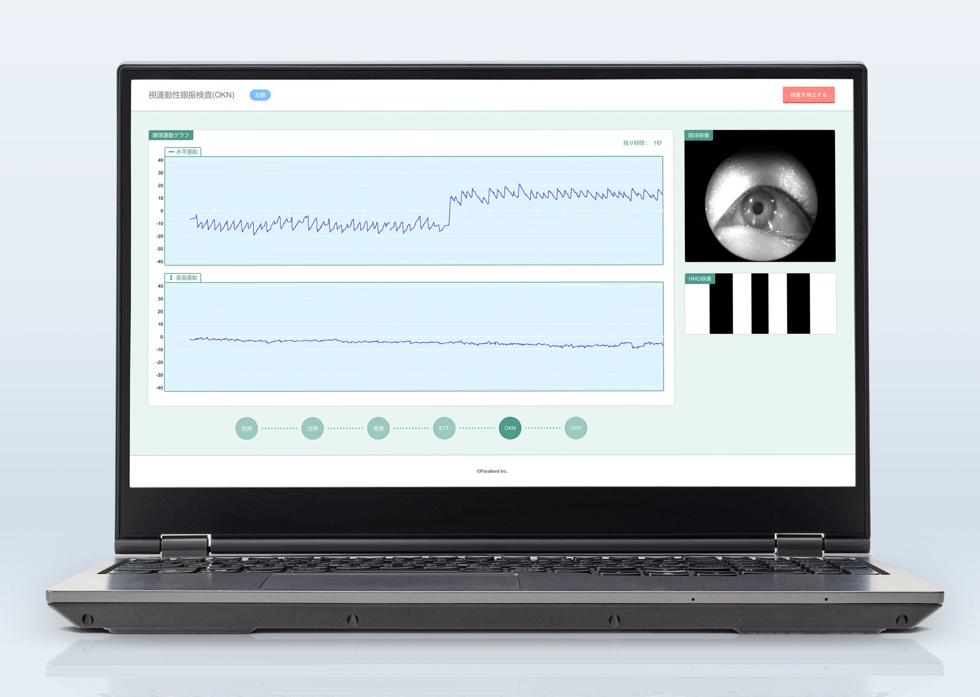 REEVEER-PitEye検査画面イメージ