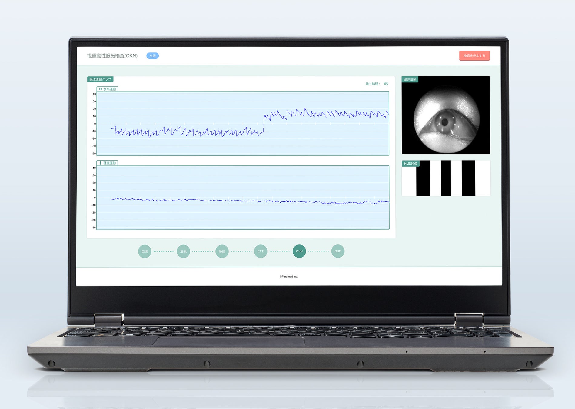 REEVEER-PitEye検査画面イメージ