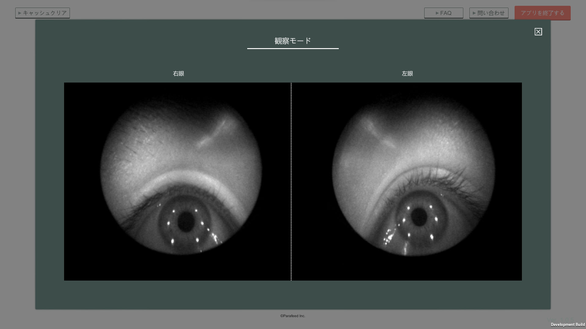 観察モード中画面