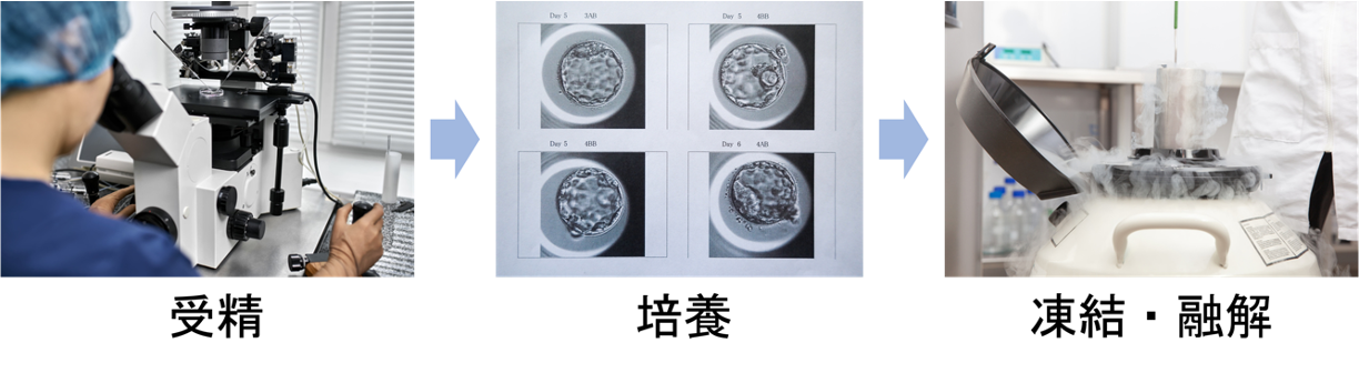 生殖補助医療の各工程（イメージ）