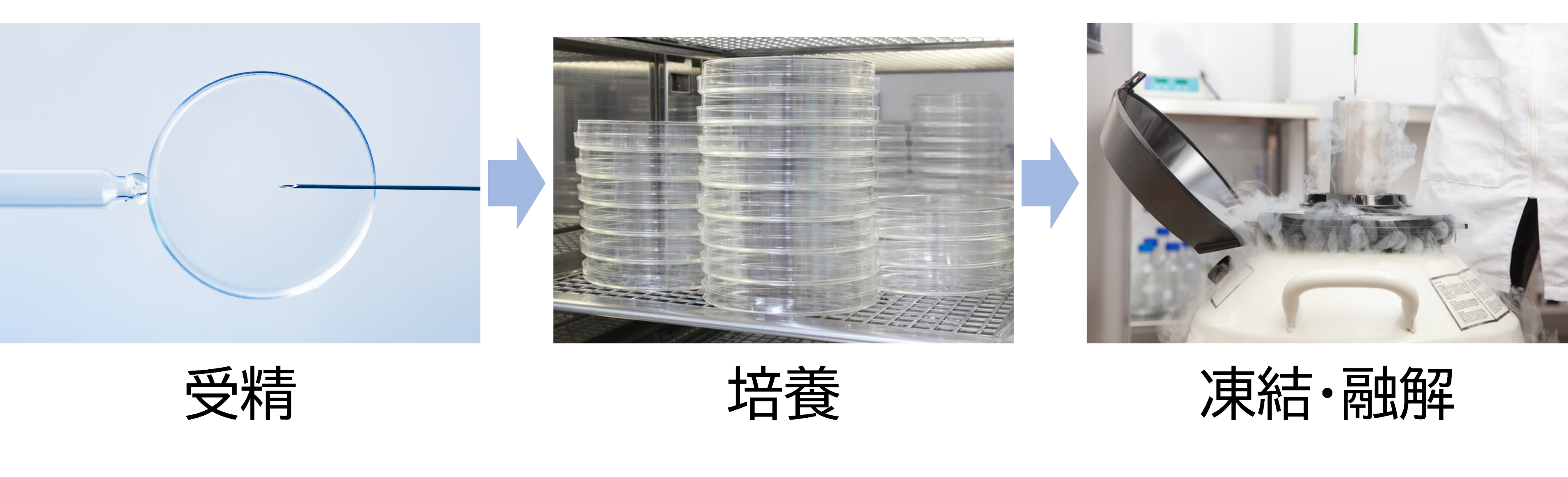 生殖補助医療の各工程（イメージ）
