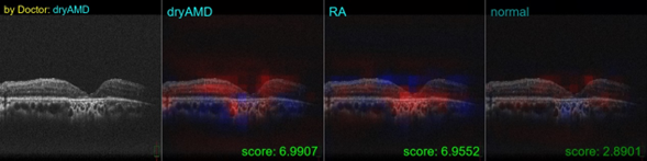 複数の分類に対し同様の処理を行うことで、画像分類結果ごとに正負の寄与領域を表示できる。