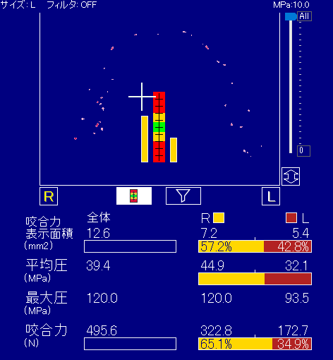 池田プロの測定結果