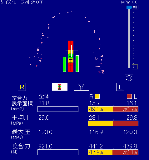 高井選手の噛むチカラ測定結果①咬合力【単位：N（ニュートン）】：921.0N  ②咬合力左右差：左52.1%、右47.9%