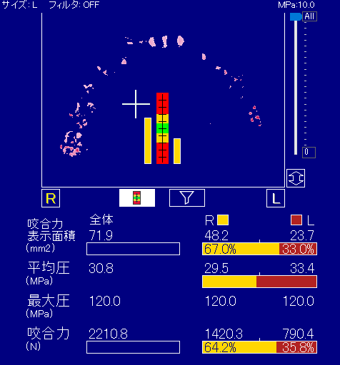 選手Cさん　測定結果 ①：2210.8N ②：左35.8%、右64.2%