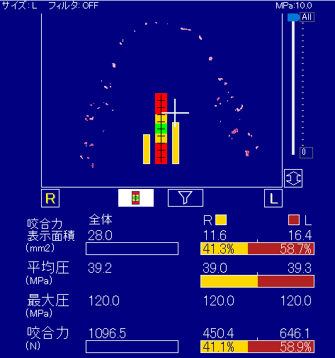 選手Aさん　測定結果 ①：1096.5N ②：左58.9%、右41.1%