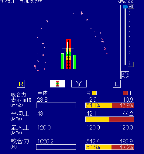 選手Dさん　測定結果 ①：1026.2N ②：左47.2%、右52.8%