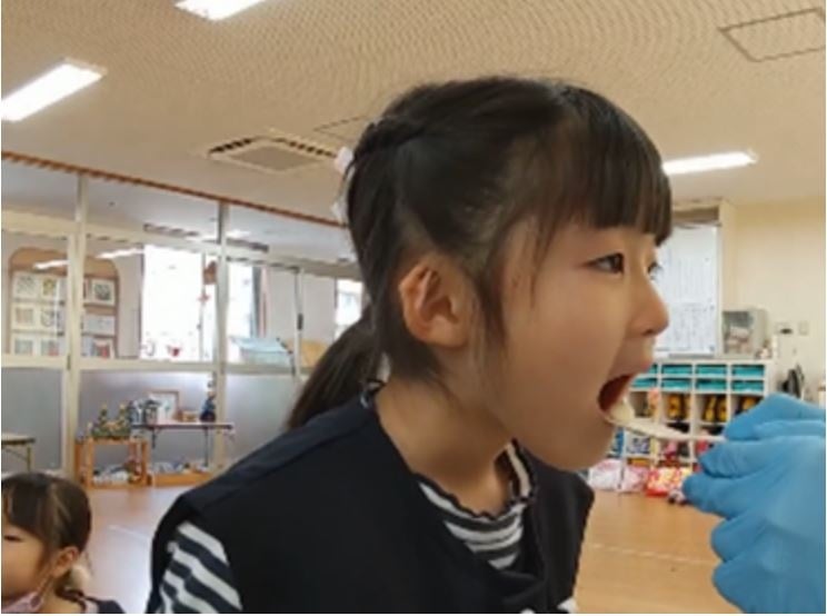 上口唇捕捉テスト