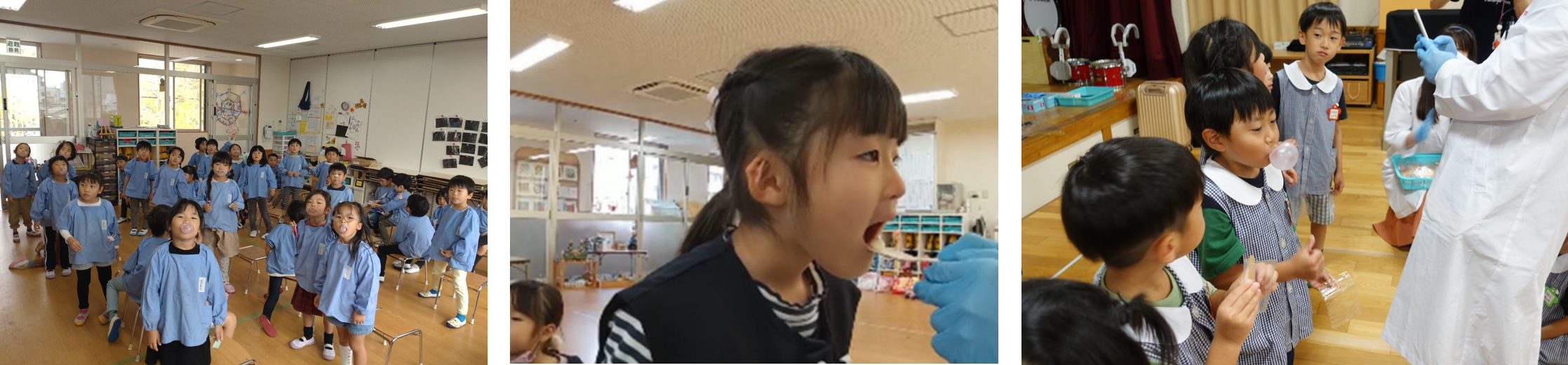 フーセンガムトレーニングの様子　　　　　　　上口唇捕捉テスト　　　　　　　　フーセンガムを膨らませる様子