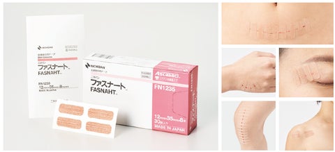 手術創や挫創・切創の閉鎖、縫合部の補強に 確実な創閉鎖をサポートする皮膚接合用テープ「ファスナート(TM)」から新サイズ発売 | ニチバン ...