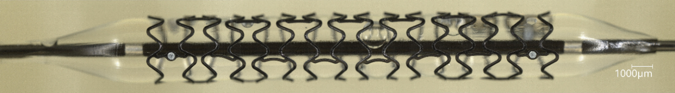 ステント拡張後