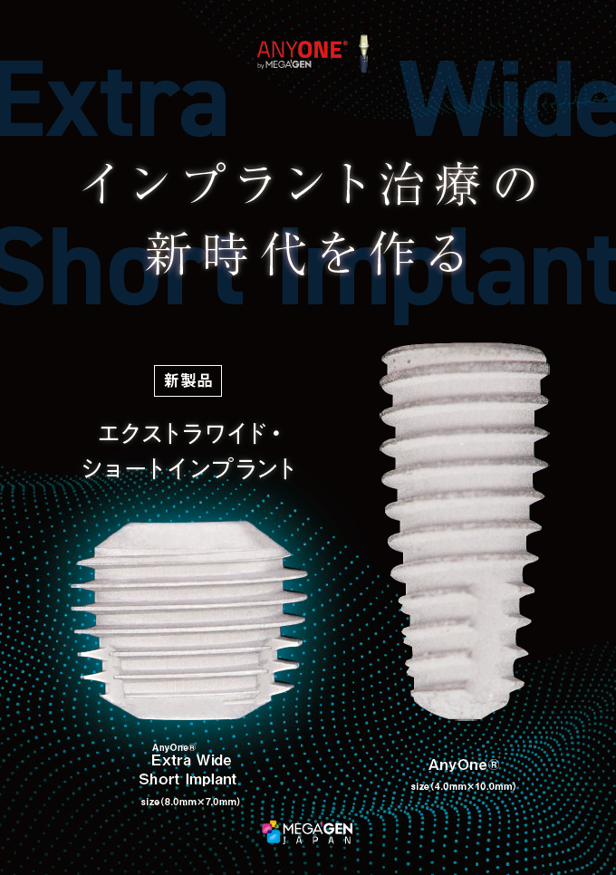 本 雑誌] ワイドショートインプラントの基礎と臨床 第5世代の