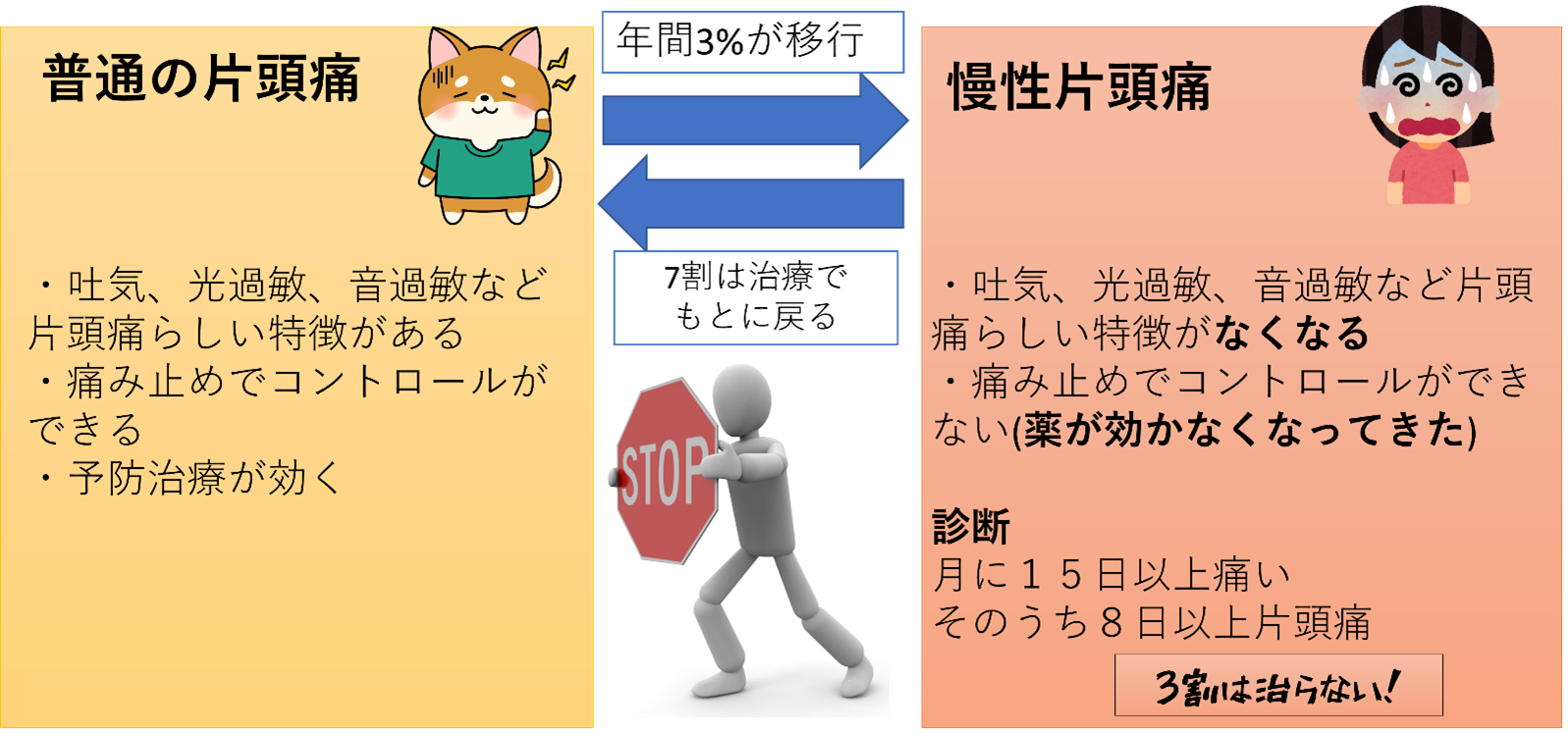 片頭痛の進行のイメージ