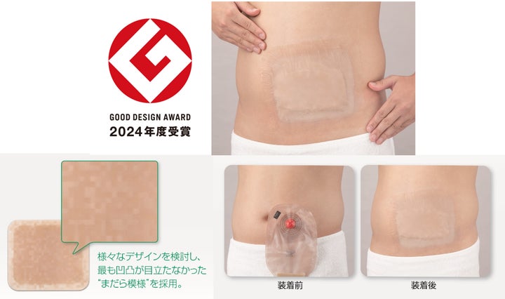 オストメイトの快適な入浴をサポートする入浴用シール〈バスラック オストメイトの快適な入浴をサポートする入浴用シール〈バスラック