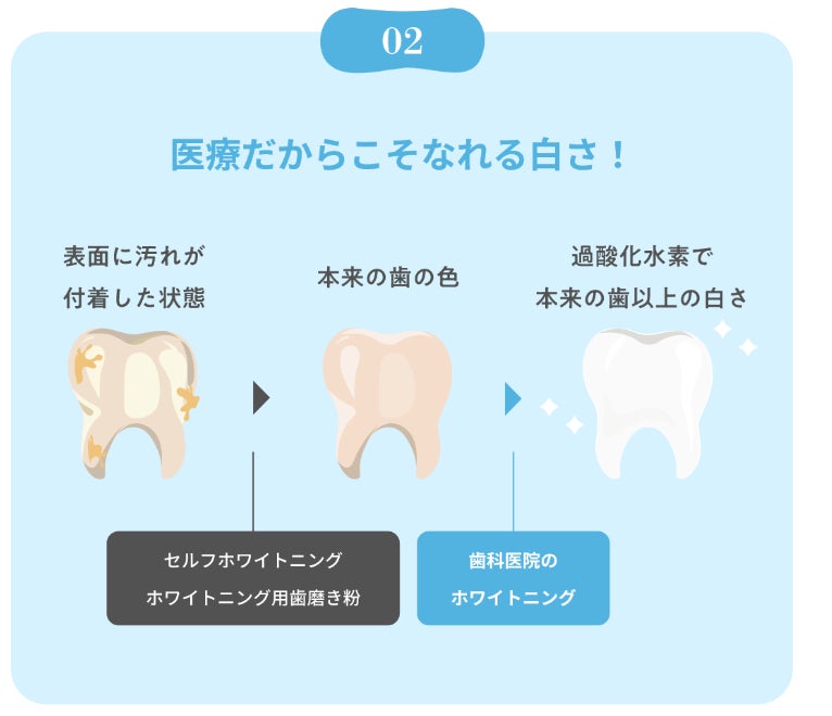 脱マスク】通わず歯医者のホームホワイトニングができる!? 業界初※1の