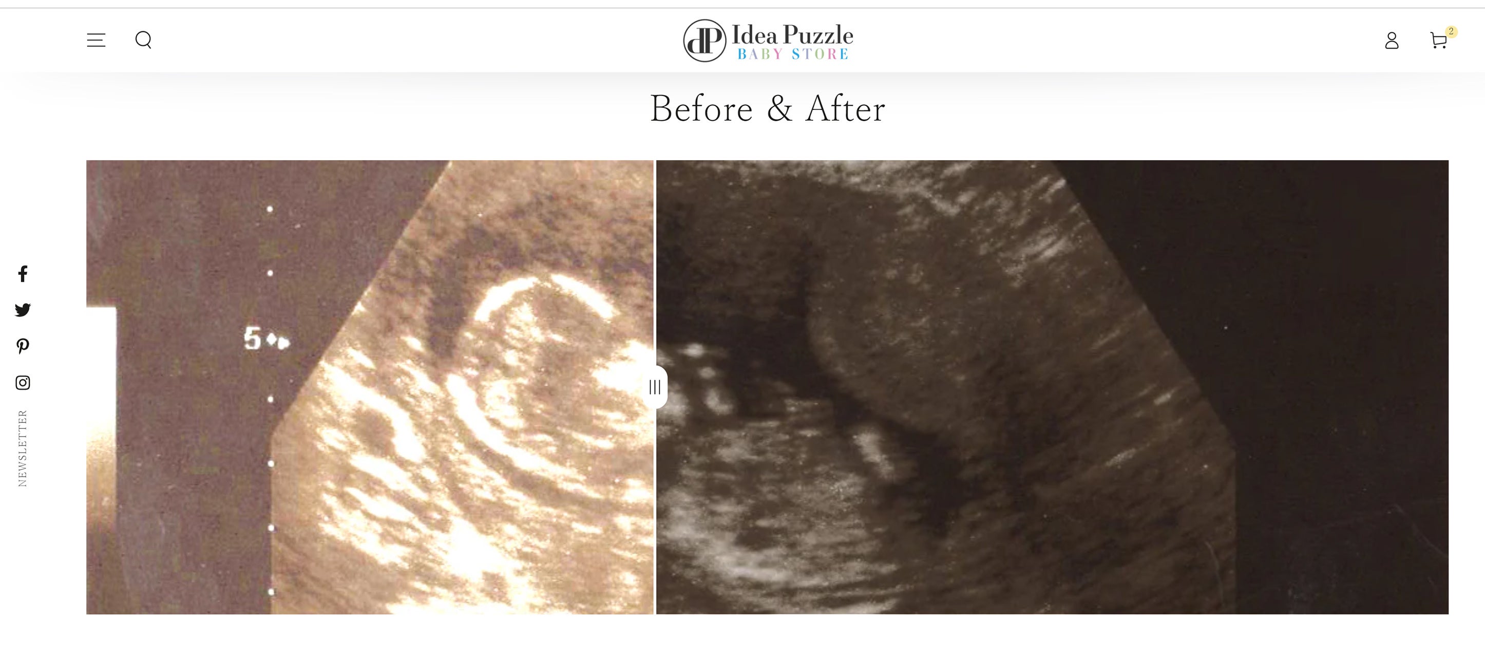 エコー写真補正