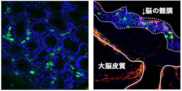 図３：慢性ストレス下において、腸管での炎症性gd17 T細胞の分化が促進され(左)、脳髄膜に移行する（右）。緑色：炎症性gd17 T細胞、赤色：脳血管のマーカー、青色：細胞核 。