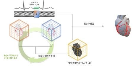 CTスキャン画像より生成される、4Dの動きベクトル フィールドのしくみ