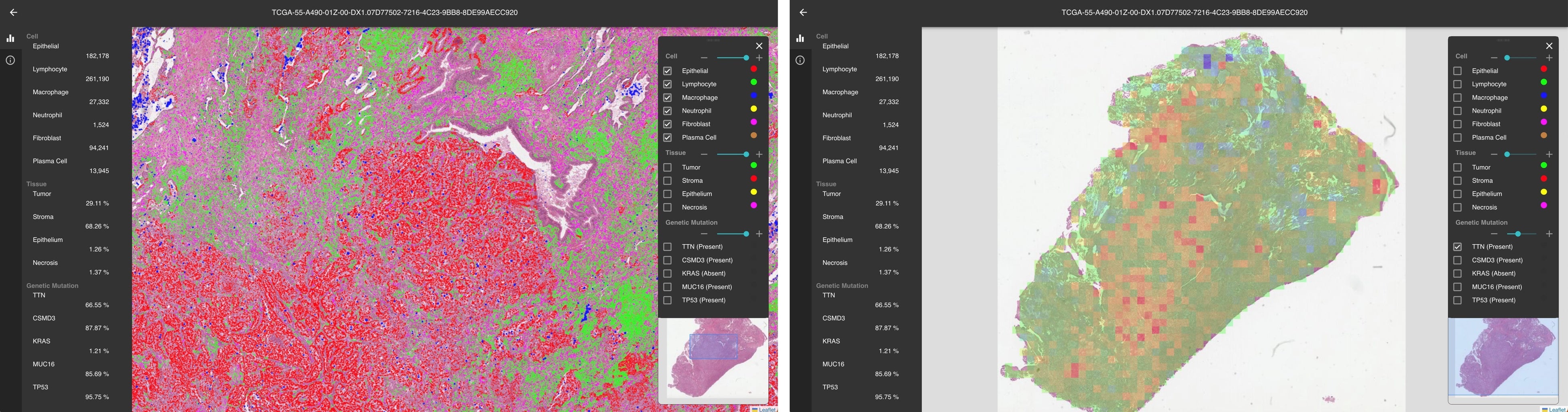 DeepPathFinderで細胞や遺伝子変異の推定結果を可視化した例（左：細胞抽出結果、右：ドライバー遺伝子変異の推定結果と変異ありと判定した場合の根拠になっている領域の可視化結果）&nbsp; 画像提供：biomy