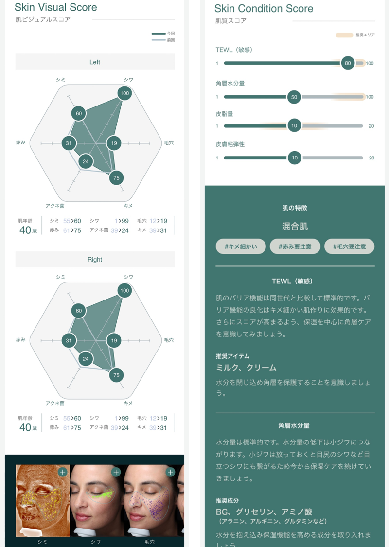 肌分析イメージ（※画像はイメージですので、実際のデザインや表示内容は変更になる可能性があります）