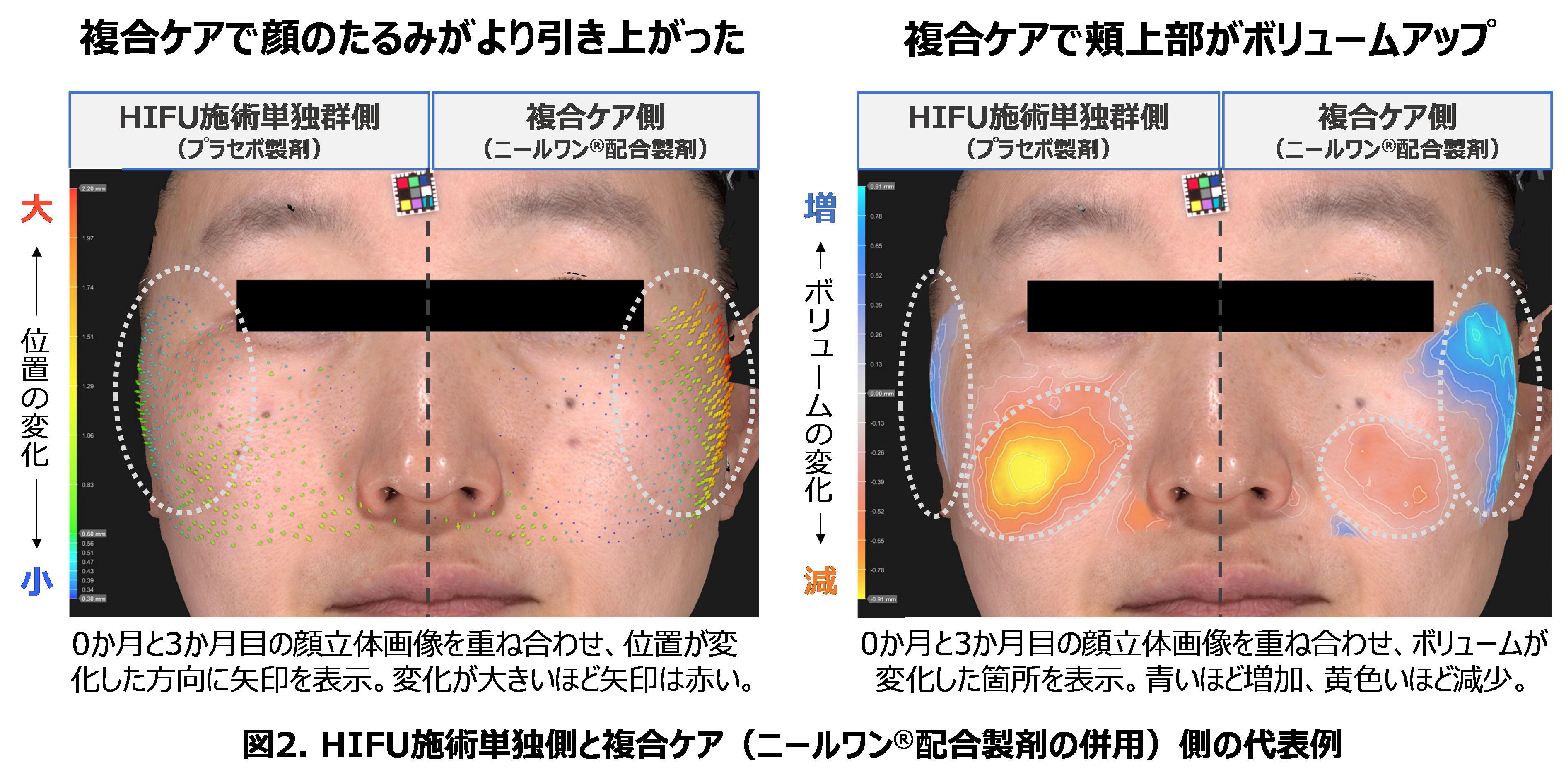 美容医療施術とニールワン®配合製剤の複合ケアで安全性と有効性を実証