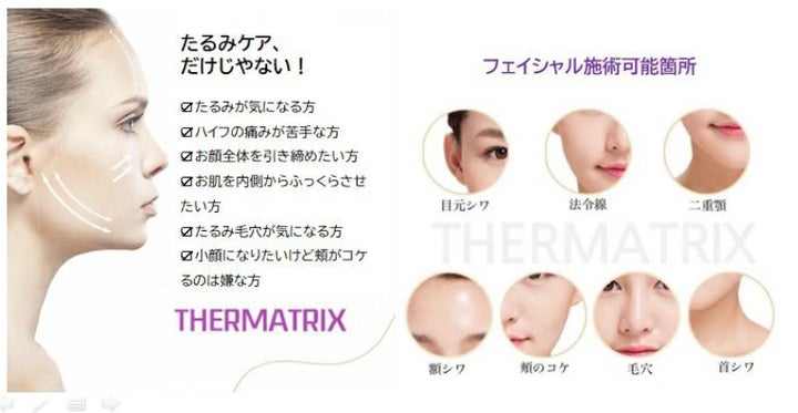 最新の肌質改善美容機器【サーマトリックス】を導入!話題の機器でニキビやたるみに効果あり 最新の肌質改善美容機器【サーマトリックス】を導入!話題の機器でニキビやたるみに効果あり