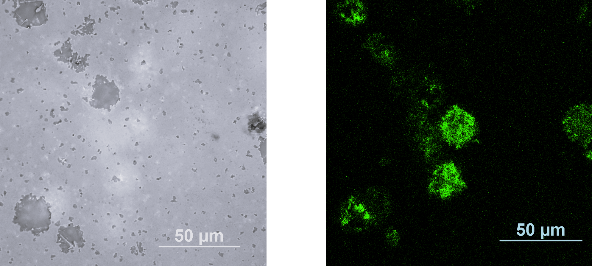 図3　粗大気孔を有する窒化ケイ素の金属顕微鏡を用いた反射像（左） 左図と同じ箇所を、レーザーを用いた蛍光顕微鏡で観察した、表面から約3µm下の蛍光像（右）