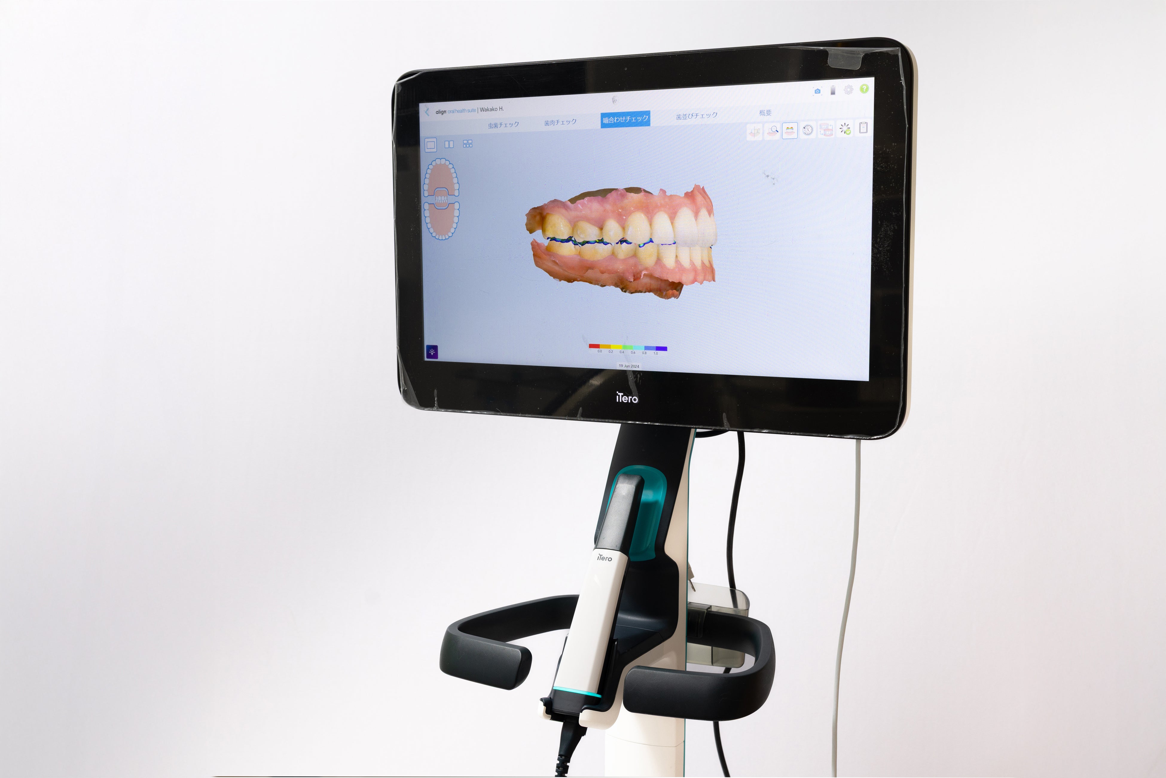 大宮区役所前歯科、口腔内スキャナー「iTero Lumina」を導入 〜初診時