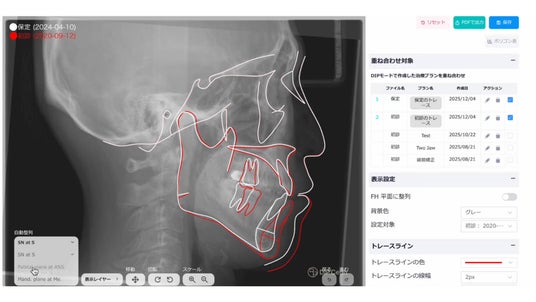 画像が削除されました