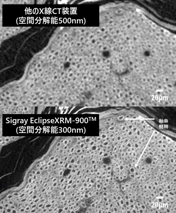 マウスの坐骨神経サンプル画像