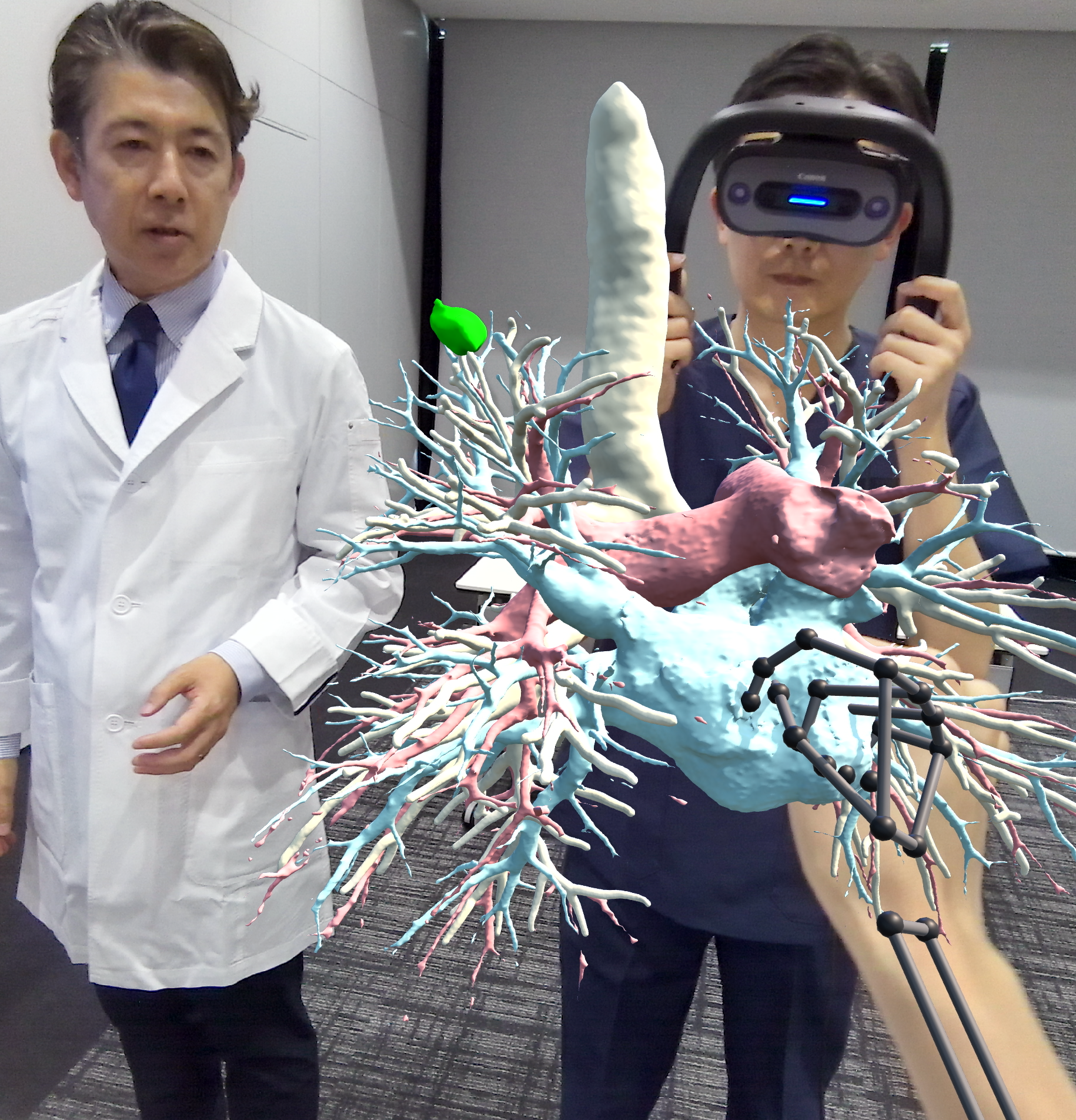 MR Anatomyの視点イメージ（見え方）　高精細な3D画像の観察が可能