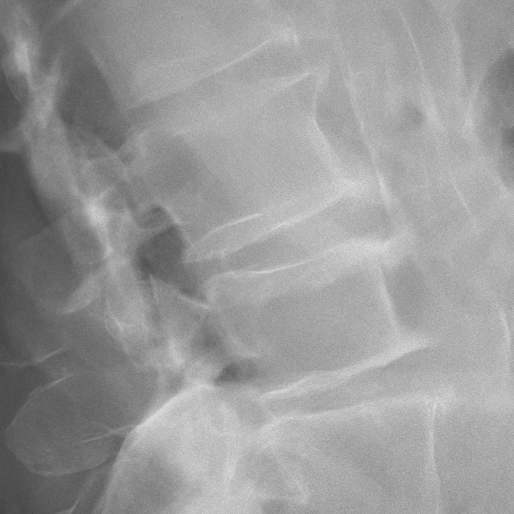 “Intelligent NR“適用画像イメージ