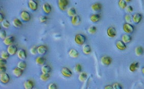 顕微鏡で見たナンノクロロプシス