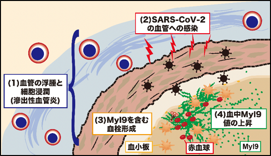 本臨床研究の成果の概要（COVID-19重症化機構）